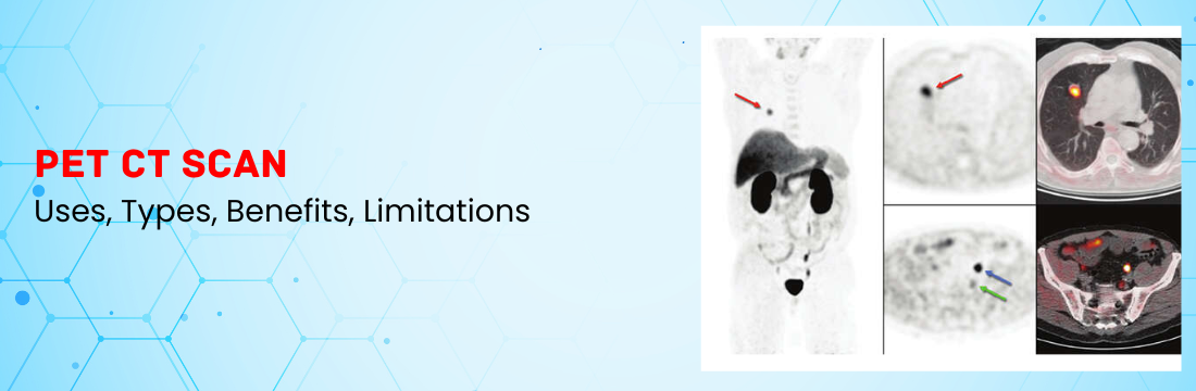 PET CT Scan: Uses, Types, Benefits, Limitations